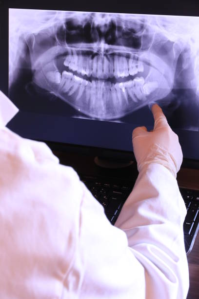Best Emergency Root Canal Treatment in Bethesda, OH